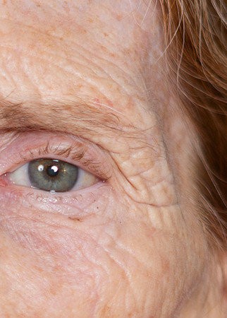IM1_0551Left eye